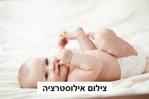 אירוע נדיר בשערי צדק: צנתור מוח לתינוק בן חודשיים